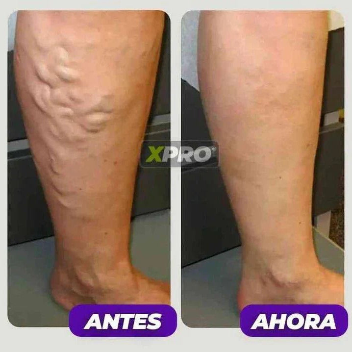 2X1 Rodilleras de Compresión PRO